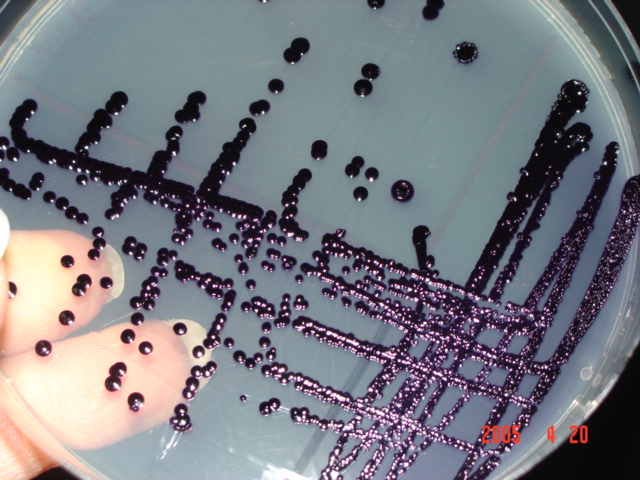 Image of Chromobacterium violaceum colonies