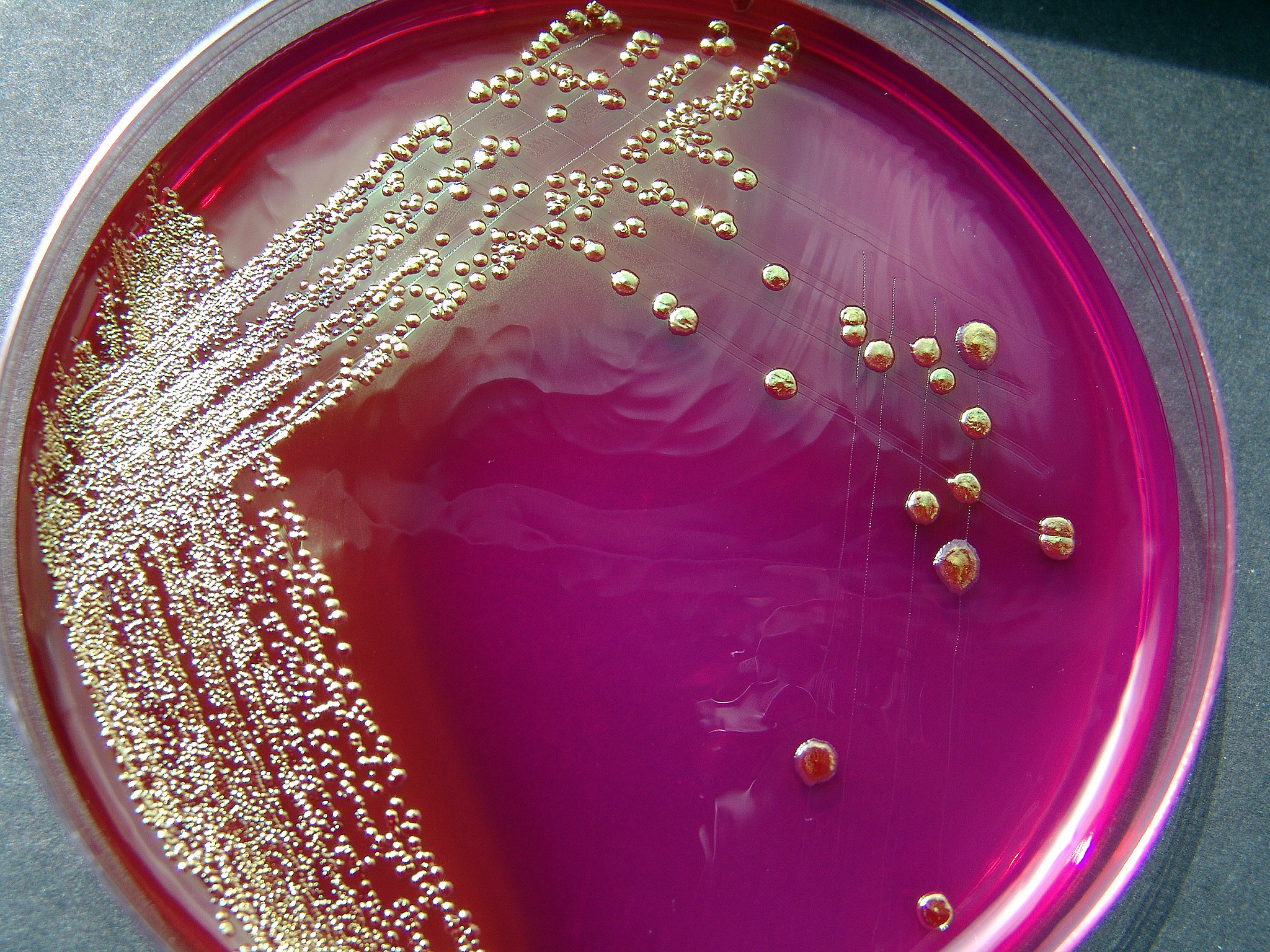 Escherichia coli | Germs and Worms